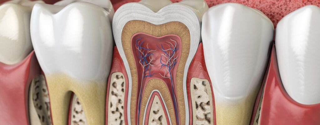root canal therapy in lake travis